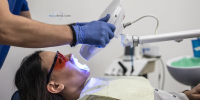Yellow Teeth Treatment